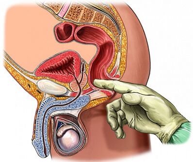 Digitalni pregled prostate
