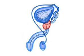risanje vnetja prostate